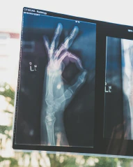 Learn about the challenges and solutions related to handling medical data, including the use of GPUs and touch devices for virtual autopsies, in this informative blog post.